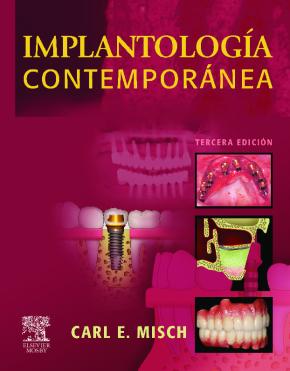 Implantologia Contemporanea (3ª Ed.)