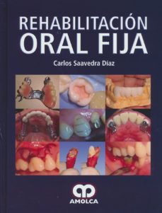 Rehabilitacion Oral Fija